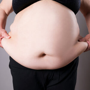 Желудочный баллон